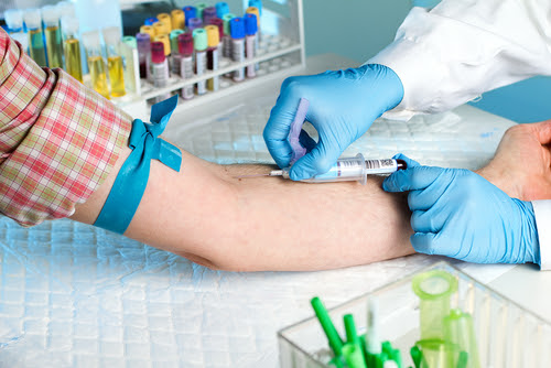blood Testing Service