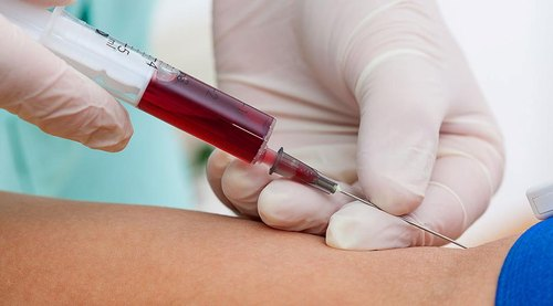 Home Collection Blood Test