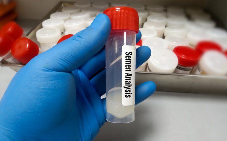 Semen Test