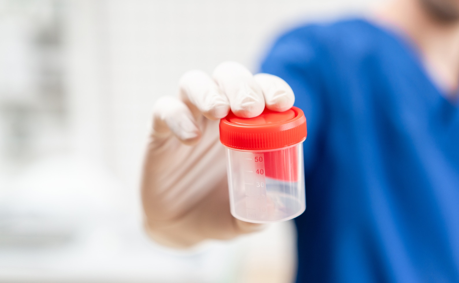 Semen Test