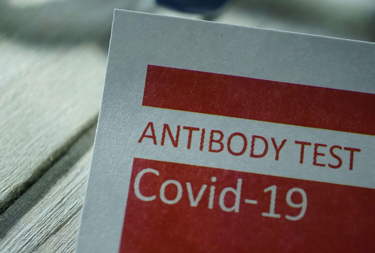 COVID Anti Body