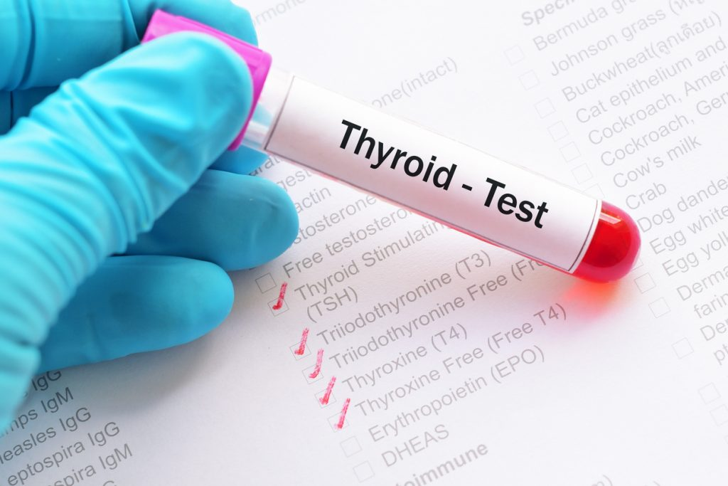 Top thyroid testing lab