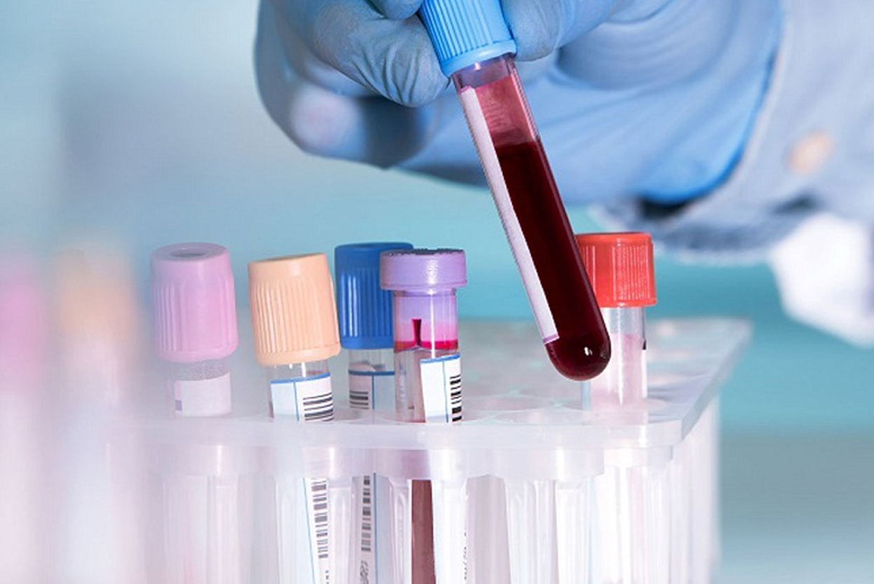 Best blood sample collection from home